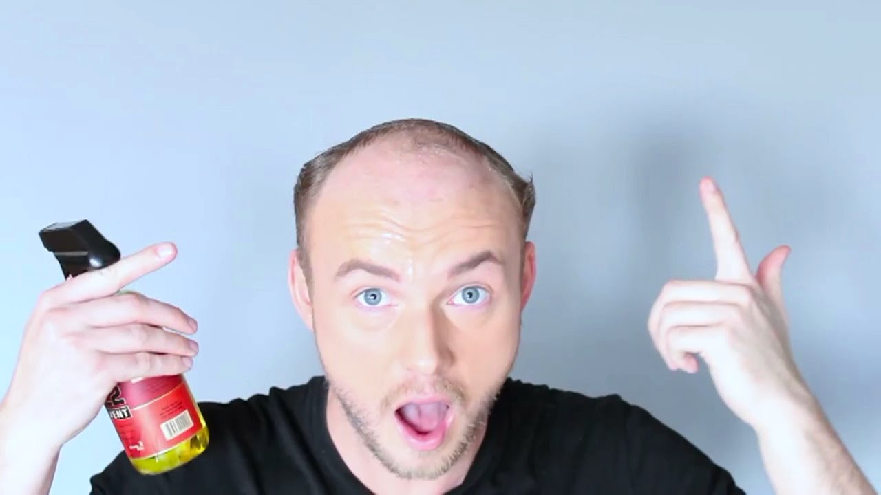 Waterproof toupee that looks just like real hair | Startup selfie