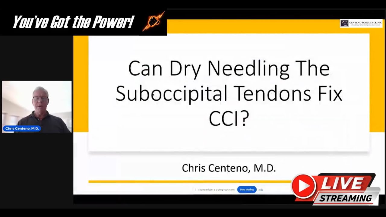 Can Tendon Dry Needling Fix CCI?