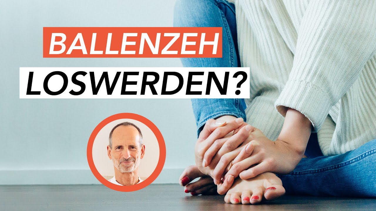 Hallux Valgus Behandlung - Diese 2 Übungen können gegen Ballenzeh helfen!