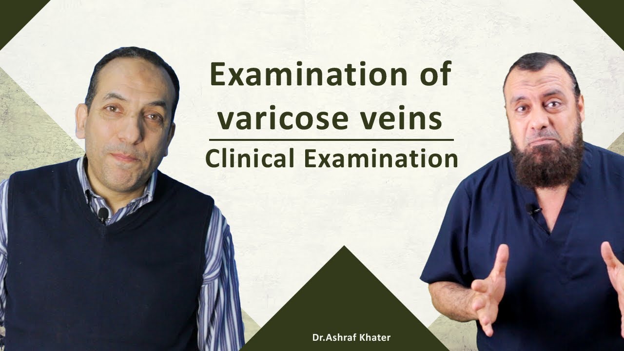 Examination of varicose veins- Clinical Examination