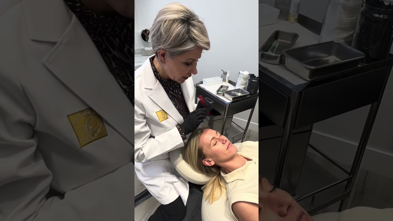 Baby Botox Treatment💉