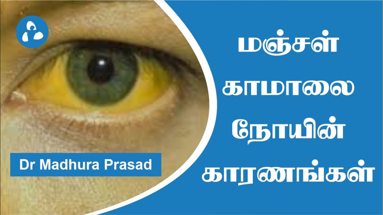 மஞ்சள் காமாலை நோயின் காரணங்கள் மற்றும் வழிமுறைகள் I Patient Education I MIC