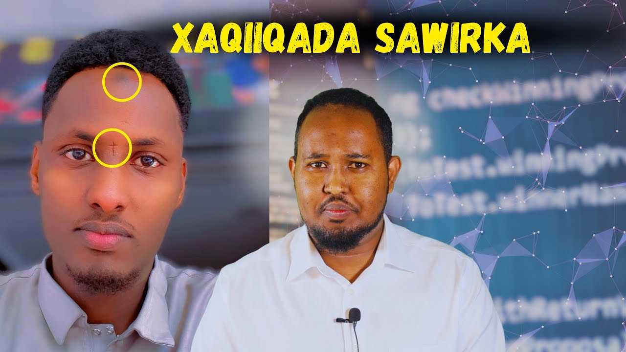 Investigation: Maxad kala socotaa sawirka Buuqa wayn abuuray ee wiilka Wajiga Calaamada ku leh?