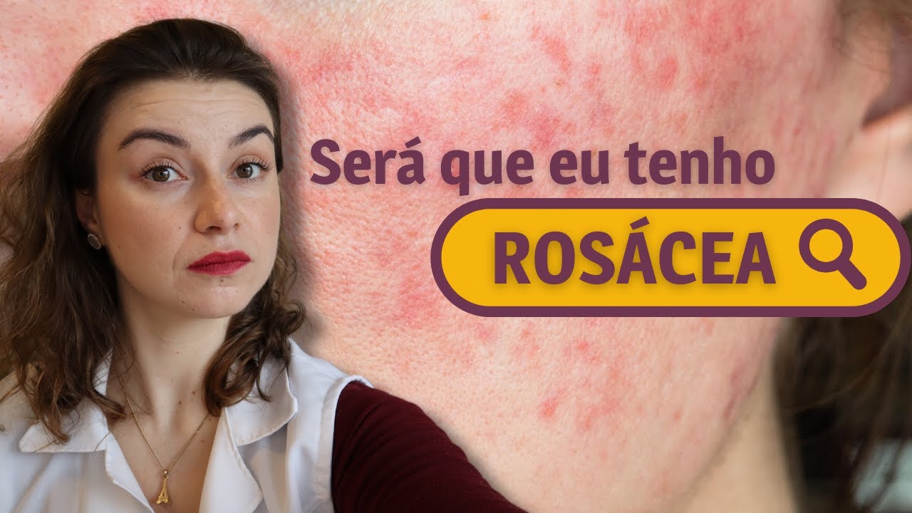 5 dicas para pele com rosácea | Dica de Esteticista
