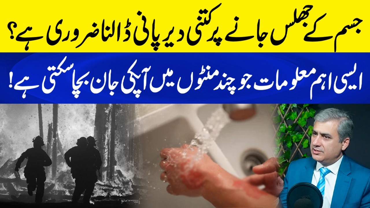 How Long Should You Cool a Burn with Water? Life-Saving First Aid Tips | Neo Plus