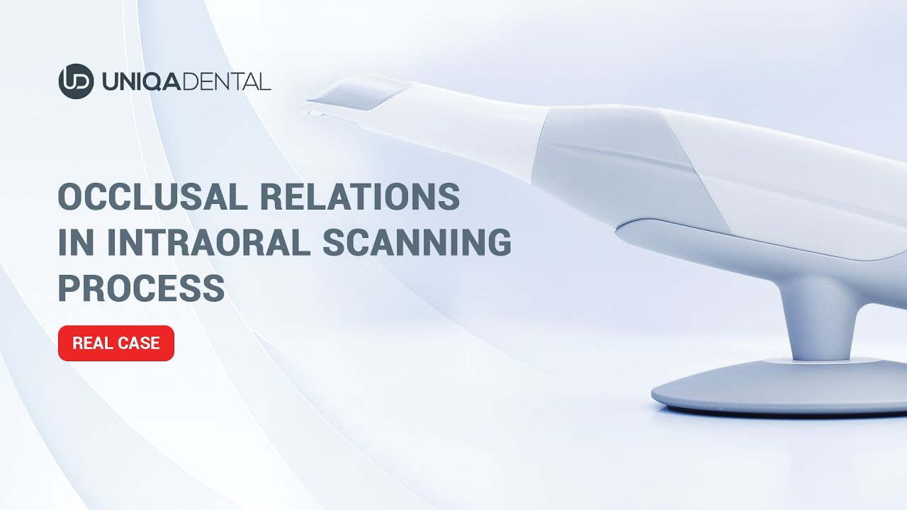 Oclussual Relations in Intraoral Scanning Process 🦷Uniqa Dental
