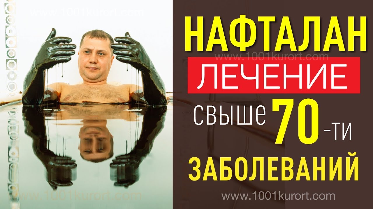 Нафталановые ванны. Рекомендации главврача санатория Чинар Нафталан, Азербайджан.