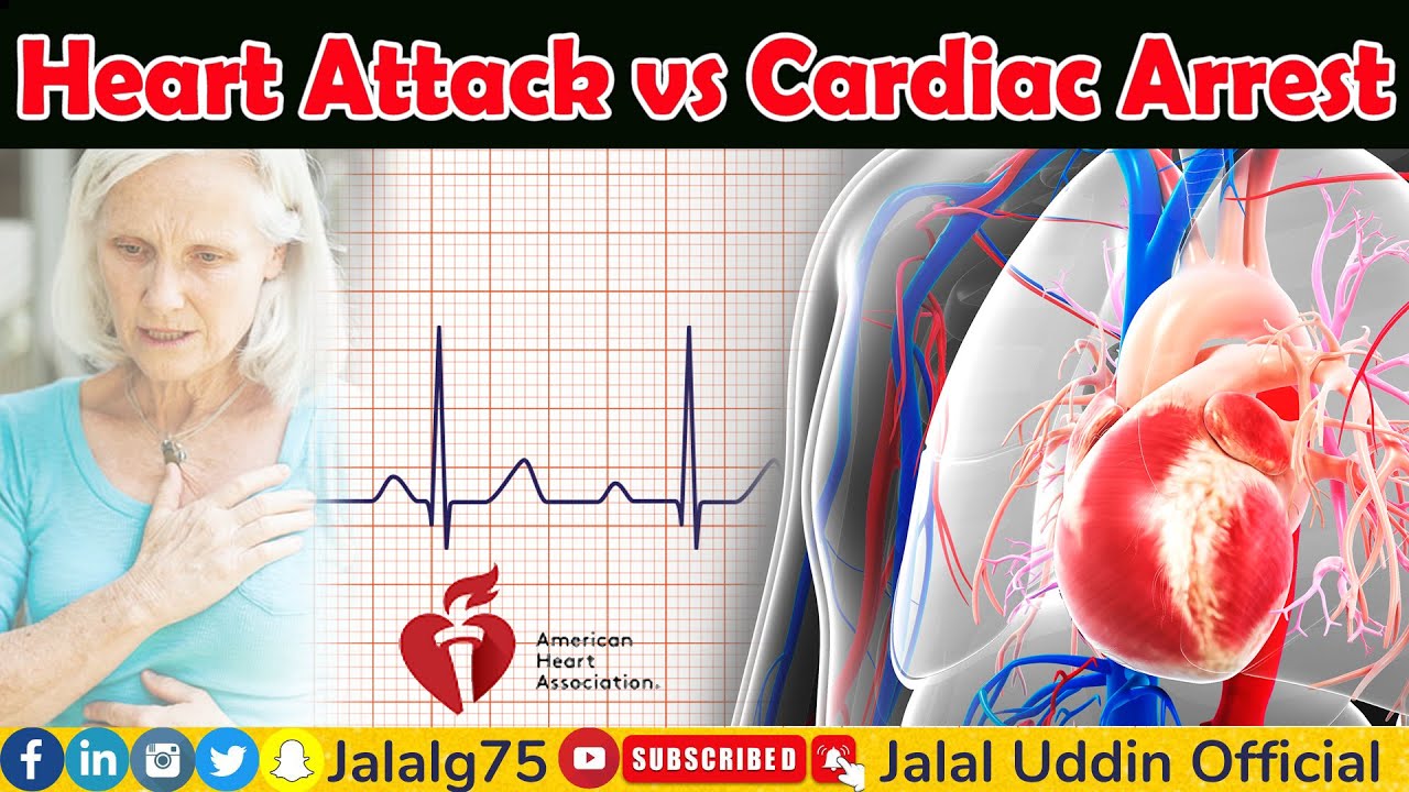 Heart Attack Vs Cardiac Arrest | AHA New Guidlines