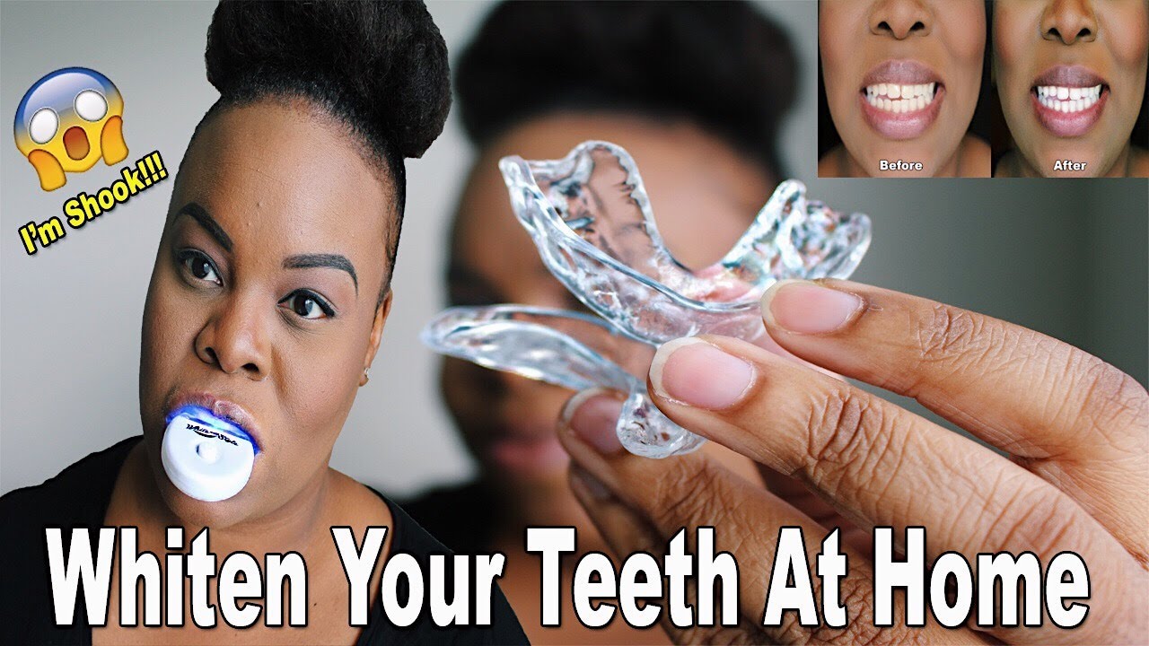 How To Get Whiter Teeth FAST!!! | Ft. White With Style