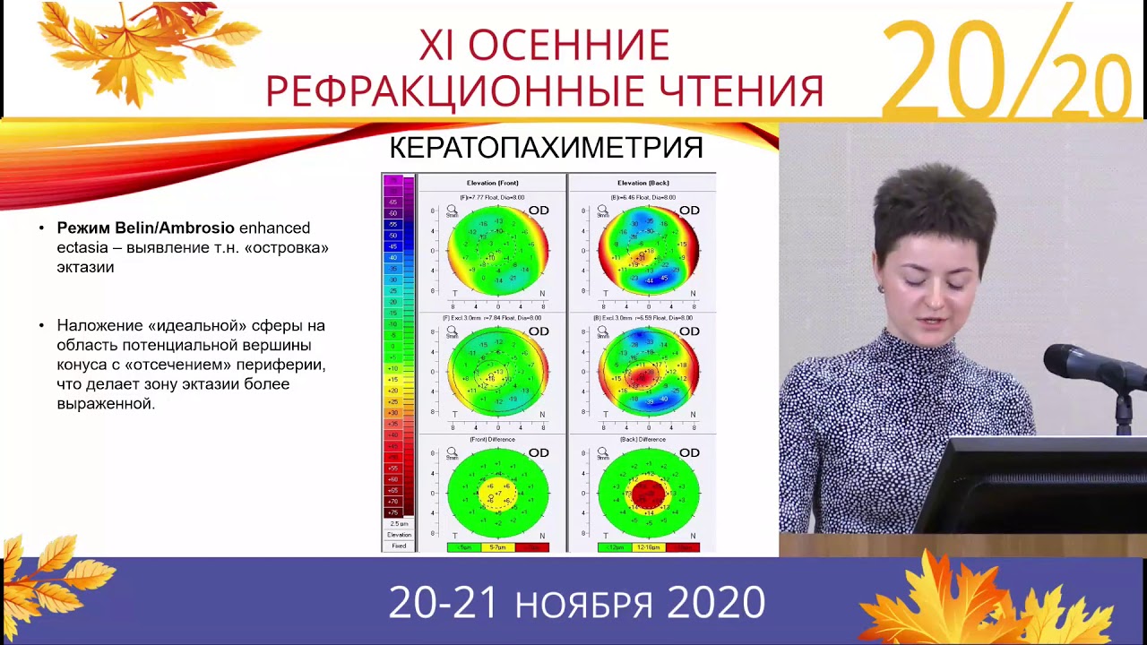 Рефракционный компонент в диагностике и лечении кератоконуса – Аверич Вероника Валерьевна