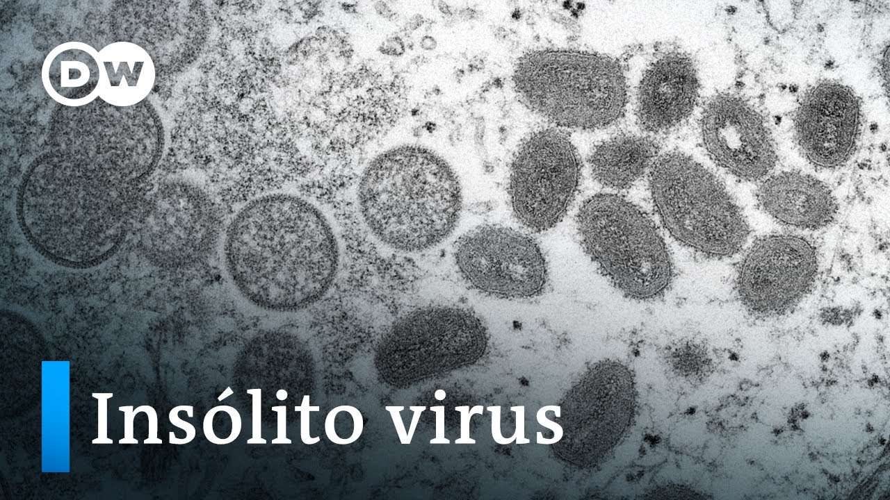 ¿Qué es la viruela del mono?