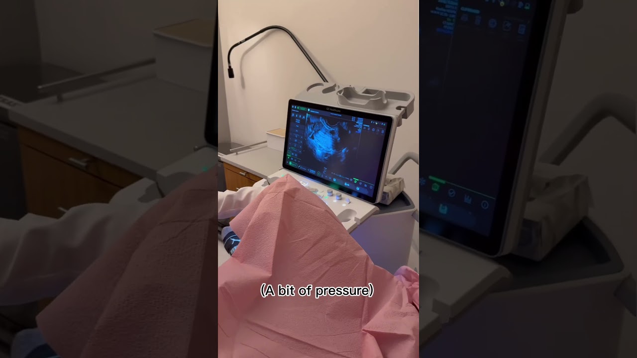 Inside a Fertility Ultrasound