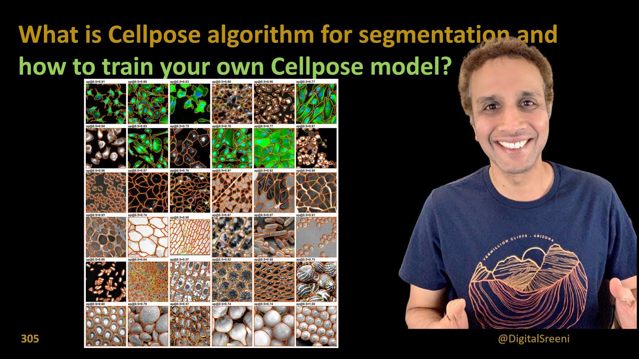 305 - Что такое алгоритм Cellpose для сегментации?