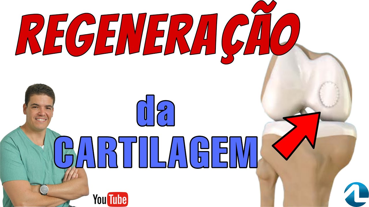 Regenera&ccedil;&atilde;o da cartilagem pela Membrana de col&aacute;geno