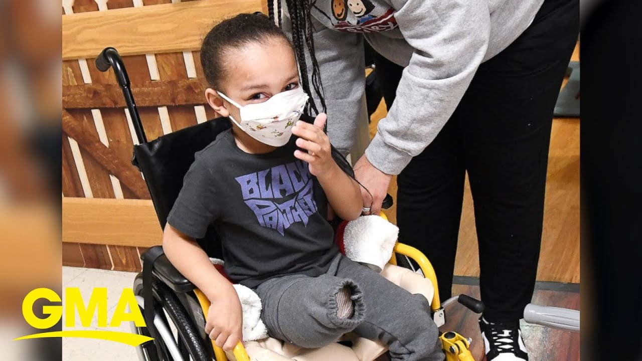 4-year-old has leg amputated after surviving rare infection l GMA