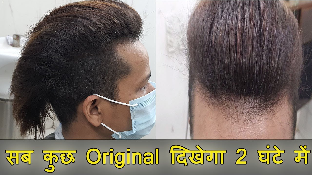 Hair Patch in Delhi | Long Length Soft Men Hair Style Patch by Planet of Hair Cloning 📱 9899746489