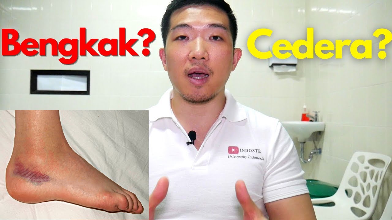 Cedera ? Bengkak ? Sembuhin sendiri yuk!