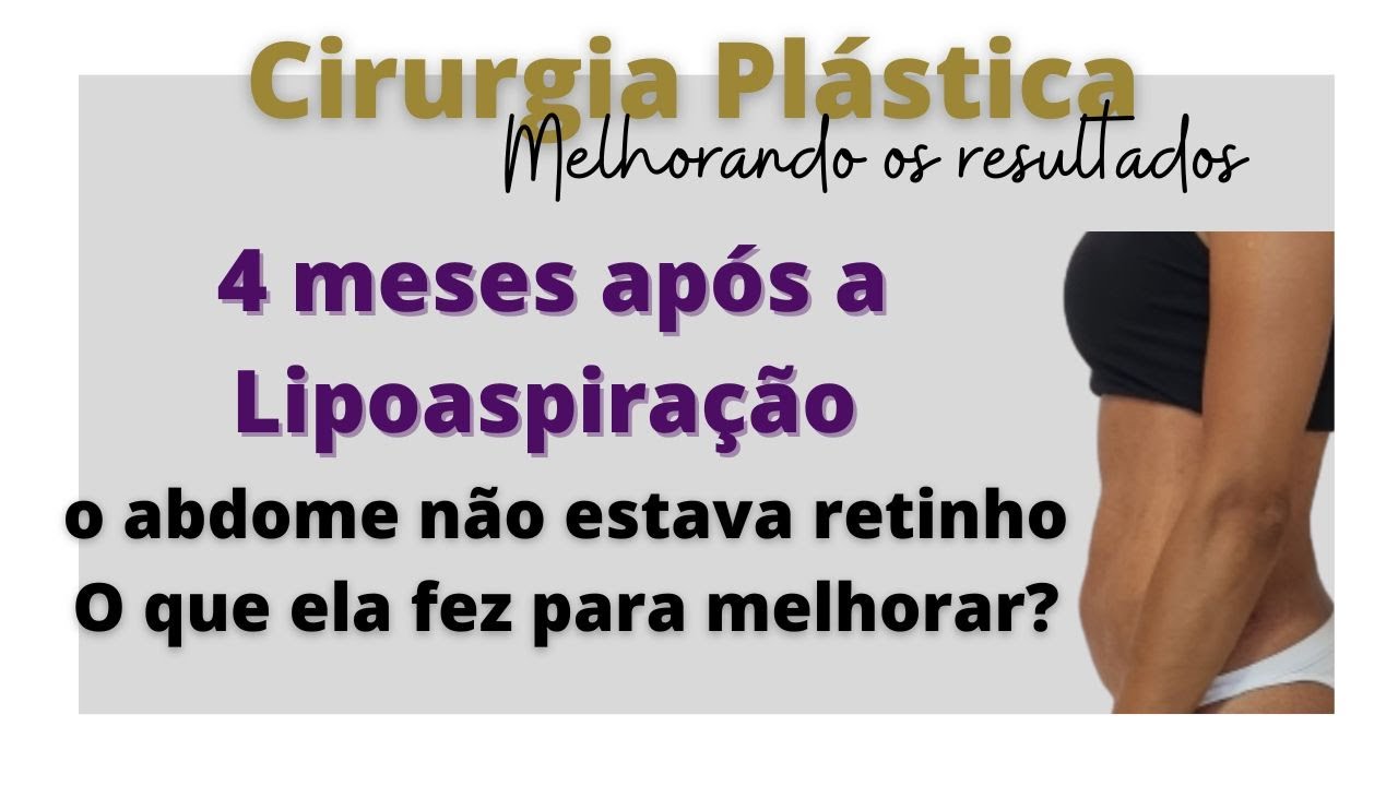 4 meses após a Lipoaspiração e o abdome não estava retinho...veja o que ela fez para melhorar!