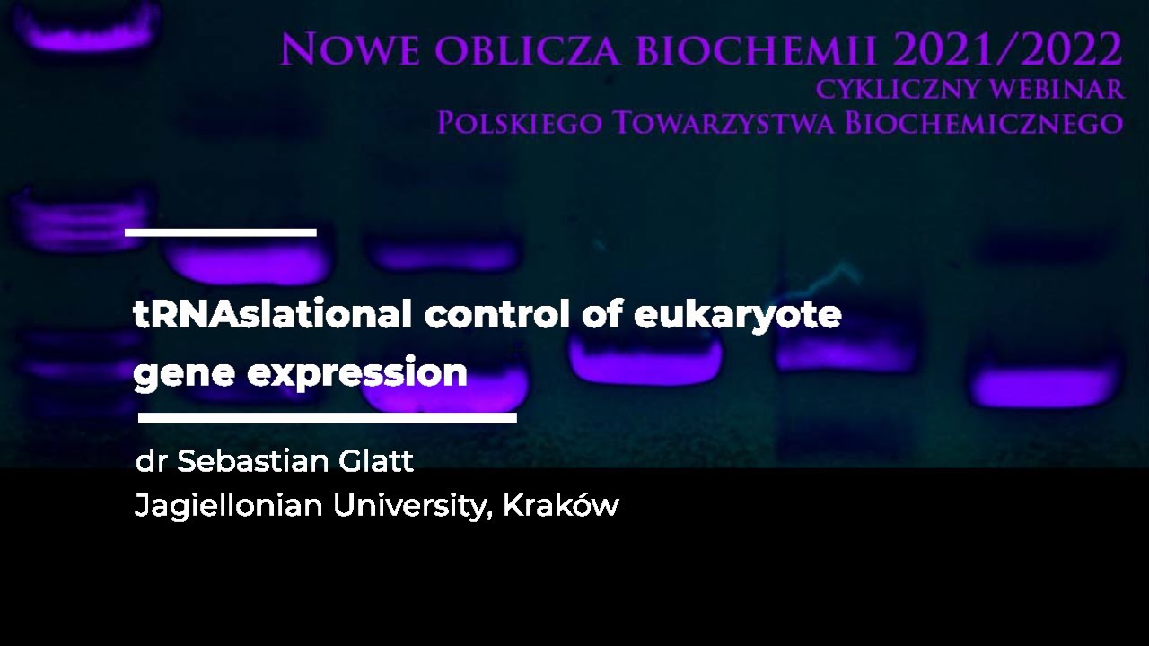 tRNAslational control of eukaryote gene expression - dr Sebastian Glatt