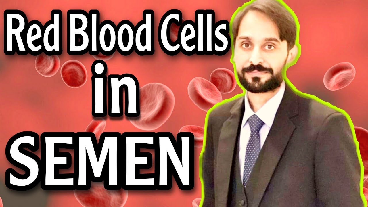 Hematospermia | Hemospermia | Causes | Diagnosis | Treatment