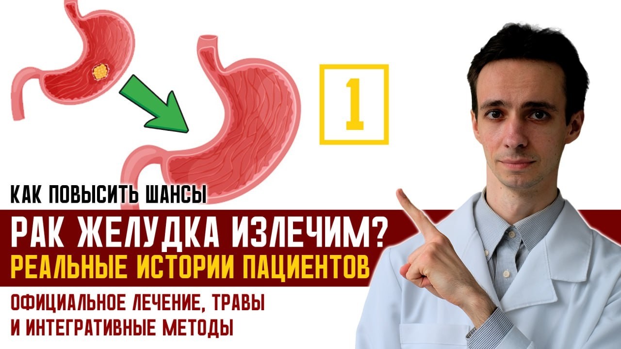 Невозможное стало возможным: Реальные истории полной ремиссии при раке желудка