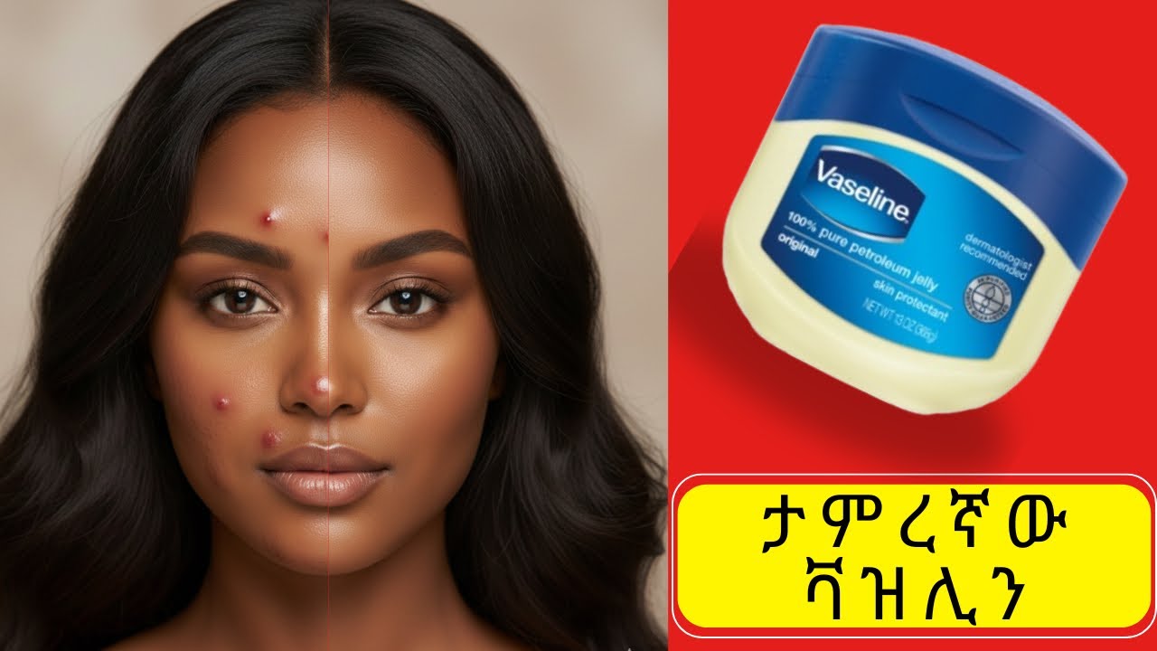 የቫዝሊን ጥቅሞች እና በፍፁም መጠቀም የሌለባቸው 3 ሰዎች ❗