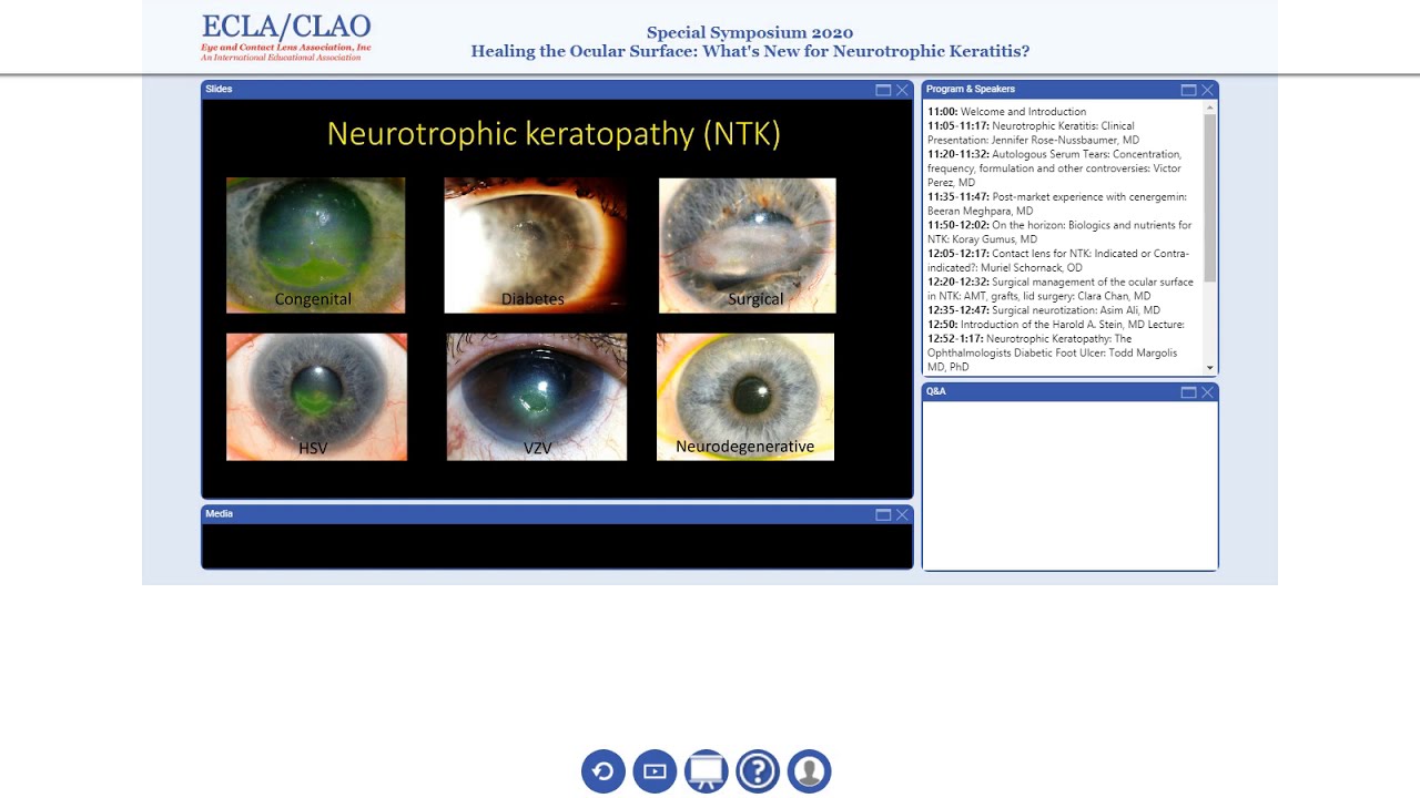 Neurotrophic Keratopathy: Opthamology's Diabetic Foot Problem