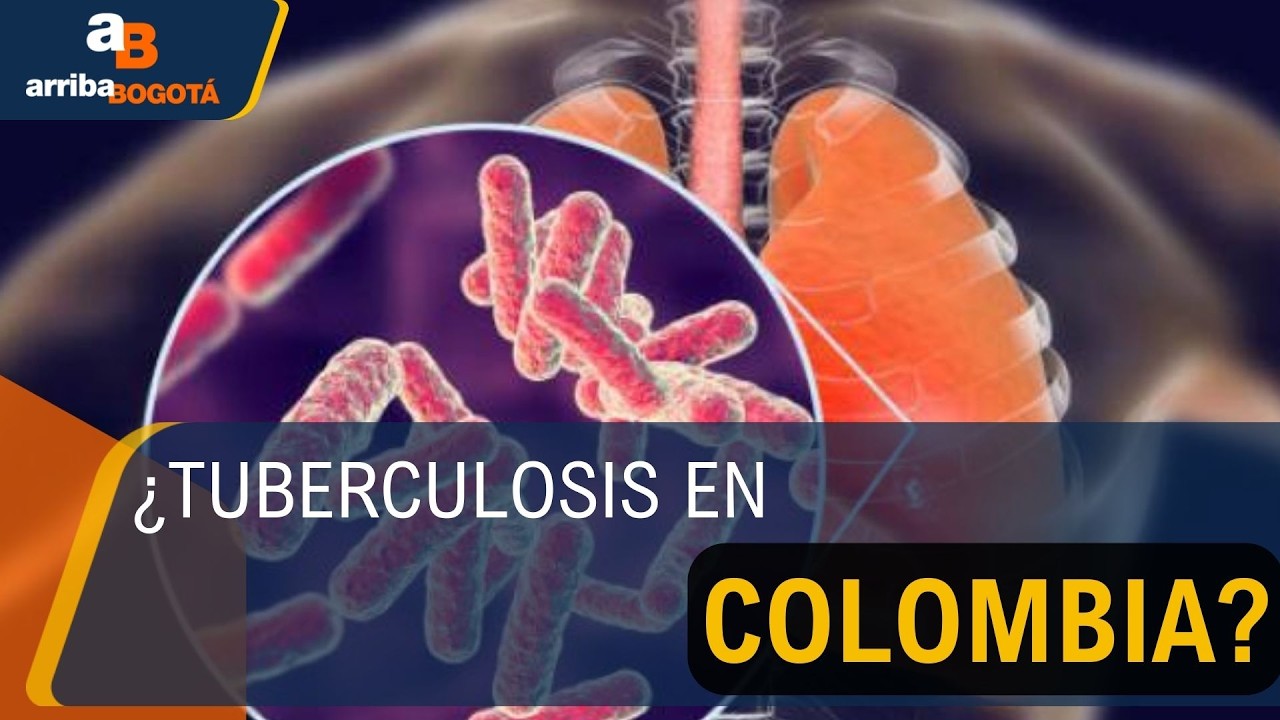 ¿Cuáles son los cuidados para evitar el contagio de la tuberculosis? | CityTv