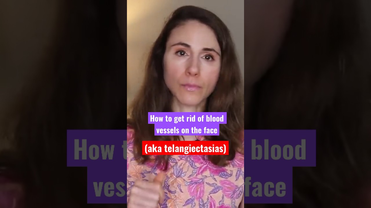 How to get rid of blood vessels on the face #dermatologist