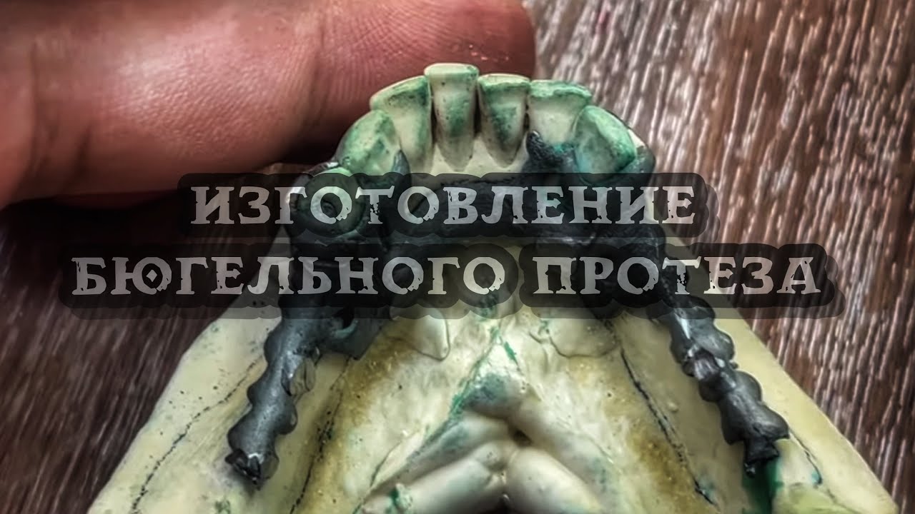 Изготовление Бюгельного протеза /Этапы производства /Обработка и полировка бюгеля