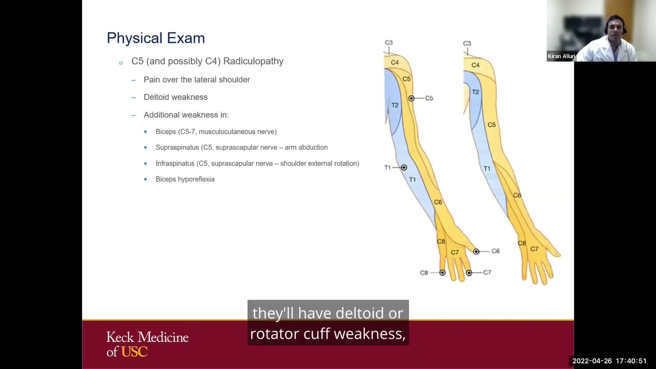 Cervical Mimickers - Cervical Neck Syndrome