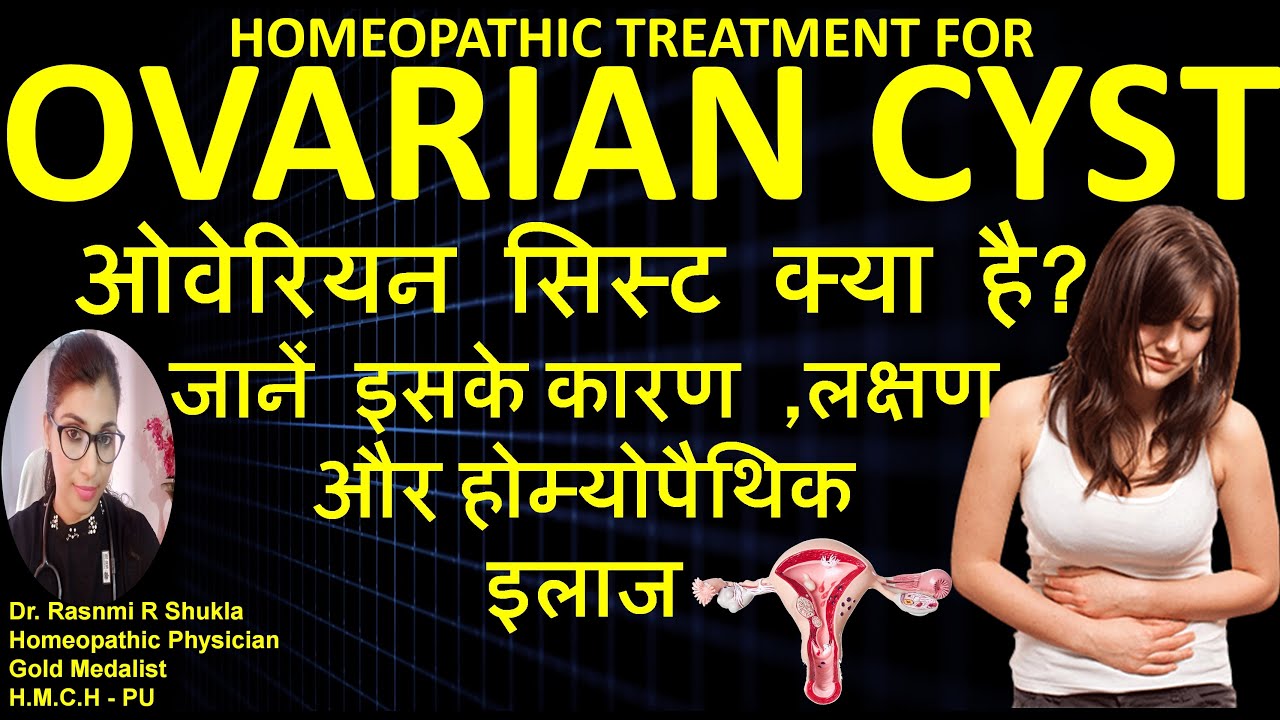 Ovarian Cyst causes symptoms and treatment | ओवेरियन सिस्ट का इलाज बिना साइड इफ़ेक्ट