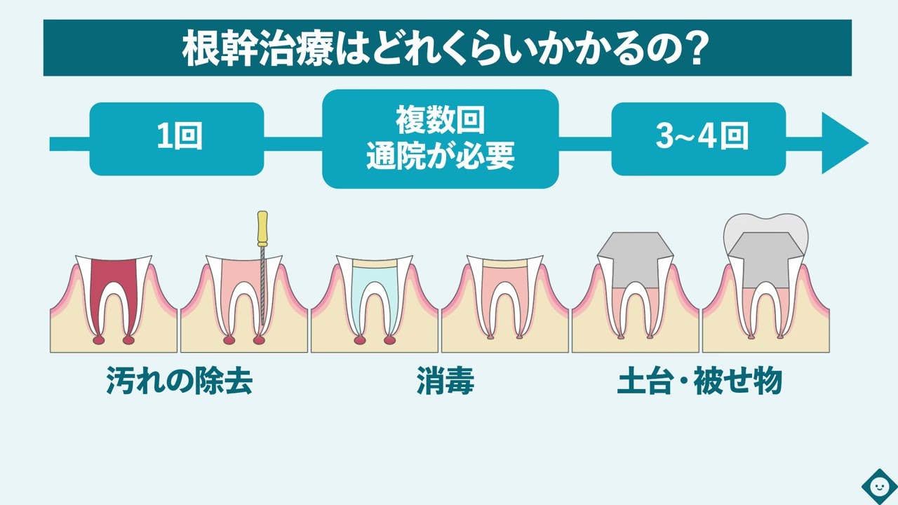 【イラストで解説】歯の根の治療（根管治療）を受けられる方へ ＃医療法人さくら会