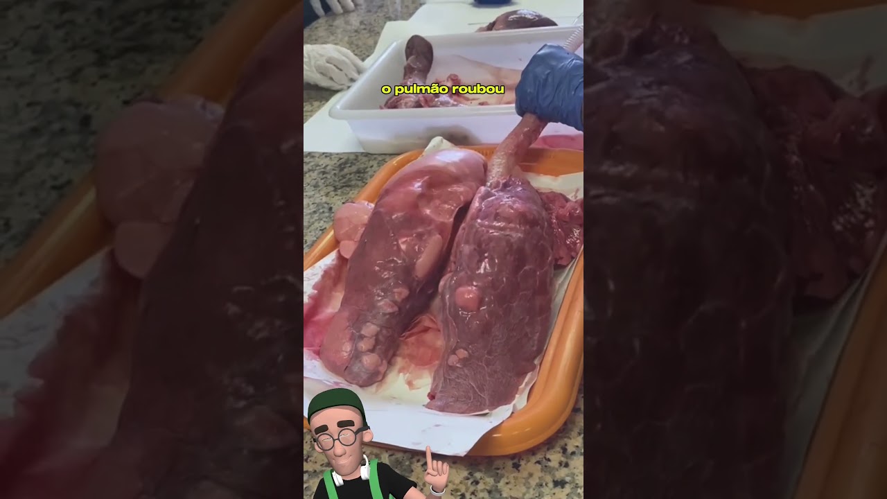 Pulm&atilde;o impressiona alunos em aula de anatomia #medicina #anatomia #ciencia #saude
