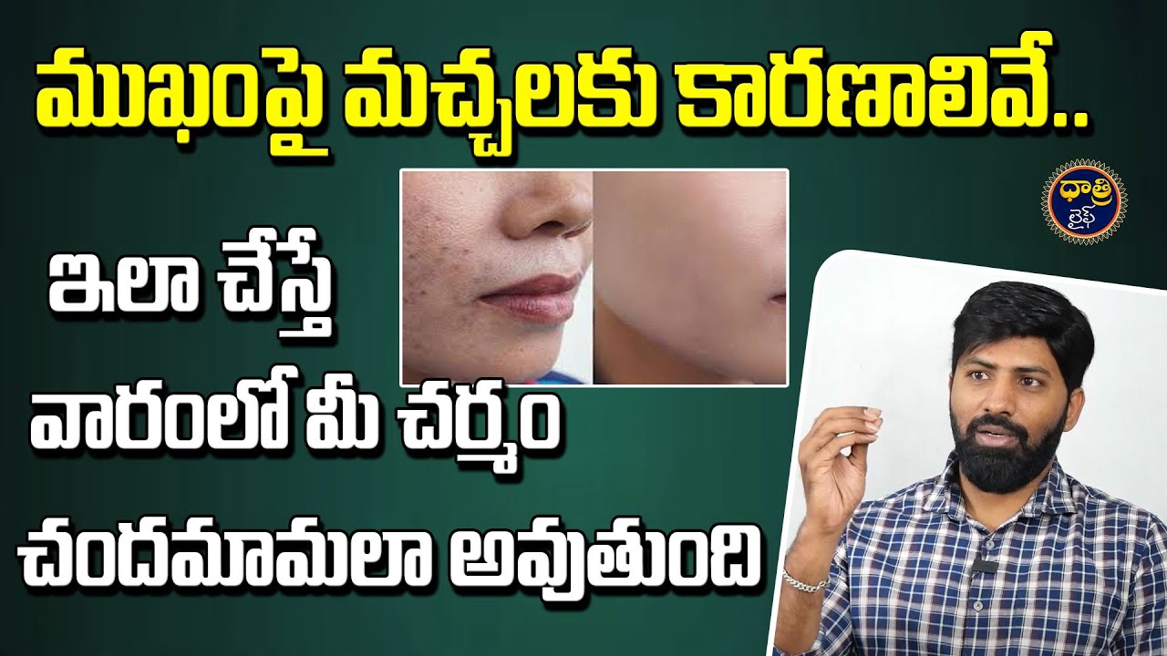 Fitness Trainer Lakshmi Narayana about Pigmentation | ముఖంపై మచ్చలకు కారణాలివే || 