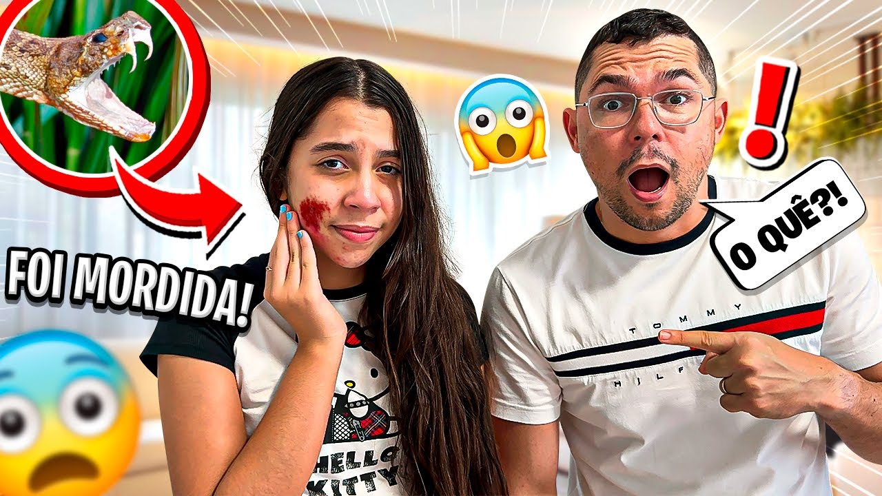 SARAH FOI MORDIDA POR UMA COBRA NO ROSTO ?!! Olha no que deu - Sarah de Araújo