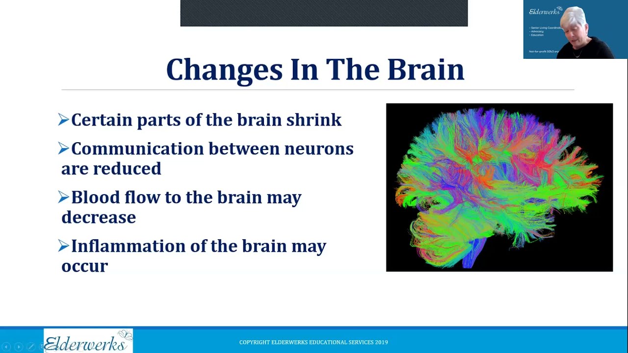 Brain Health & the Aging Brain