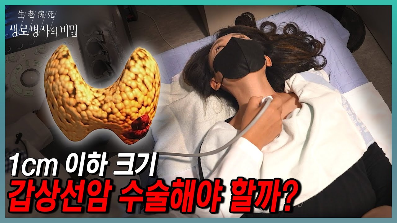 착한 암?🤨 갑상선암 그냥 지켜봐도 괜찮을까? 발견 즉시 수술 or 지켜본다? 갑상선암 확진자들의 다양한 실제 사례들 | KBS 231227 방송