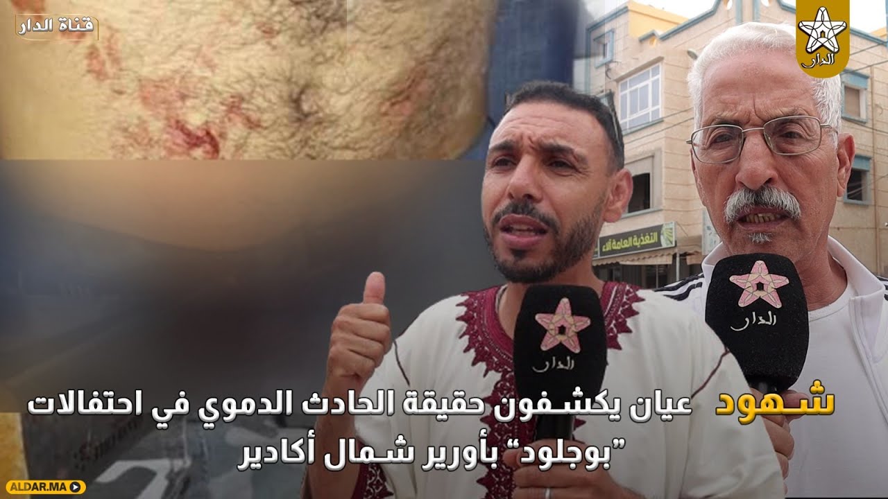 صور ”مجزرة” أورير .. شهود عيان يكشفون حقيقة الحادث الدموي في احتفالات “بوجلود” بأورير شمال أكادير