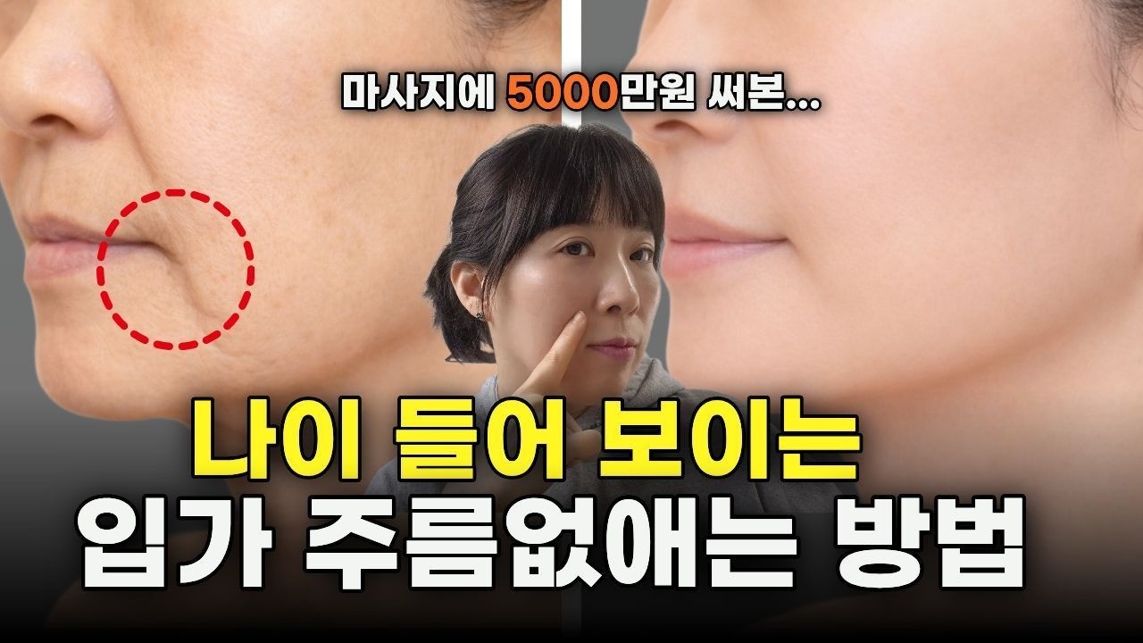늙어 보이게 만드는 입가 주름 .마리오네트 주름원인과   예방법!