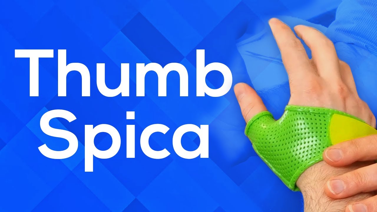How to Make a Thumb Spica Splint