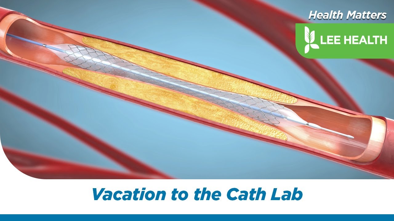 From Vacation to the Cath Lab