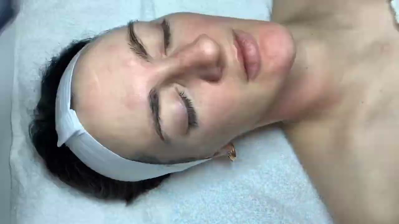 Microdermabrasion with nano infusion