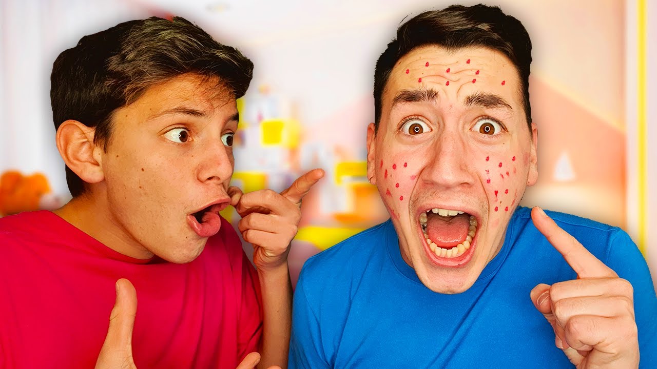 HO PRESO LA VARICELLA!! *scherzo a cap*