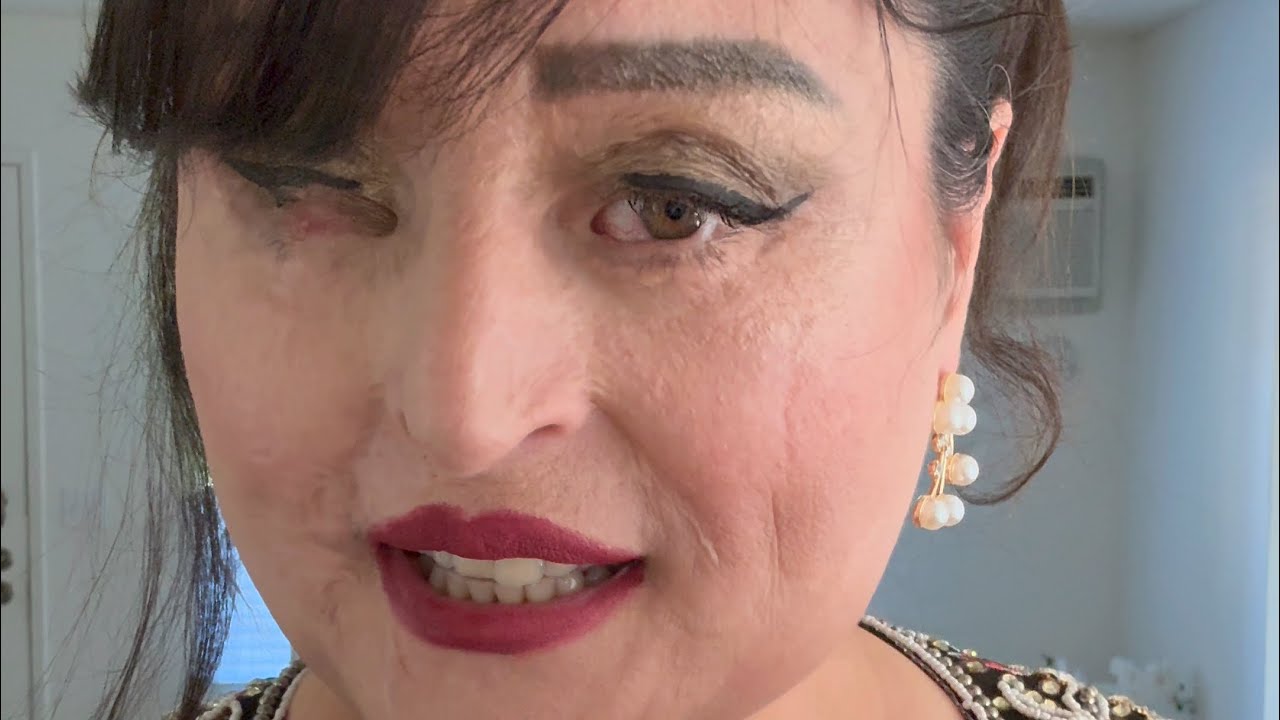 خاطره جالب ، درد ناک، و اما من زیبای بهش بخشیدم. تو سوختی و دیگر نمتوانی لوازم آرایش استفاده کنی.