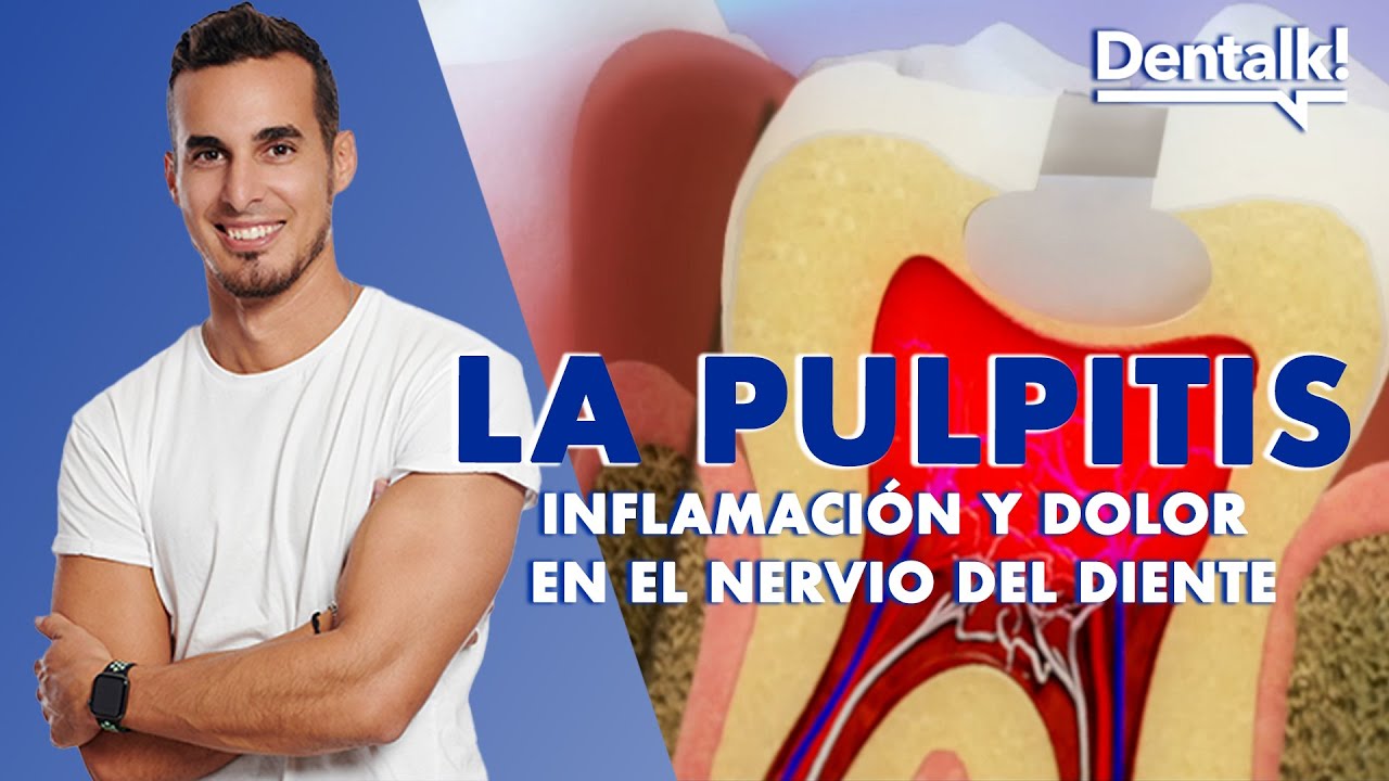 ¿Dolor de MUELAS? Podría ser PULPITIS - Tratamiento INFLAMACIÓN NERVIO dental | Dentalk! ©