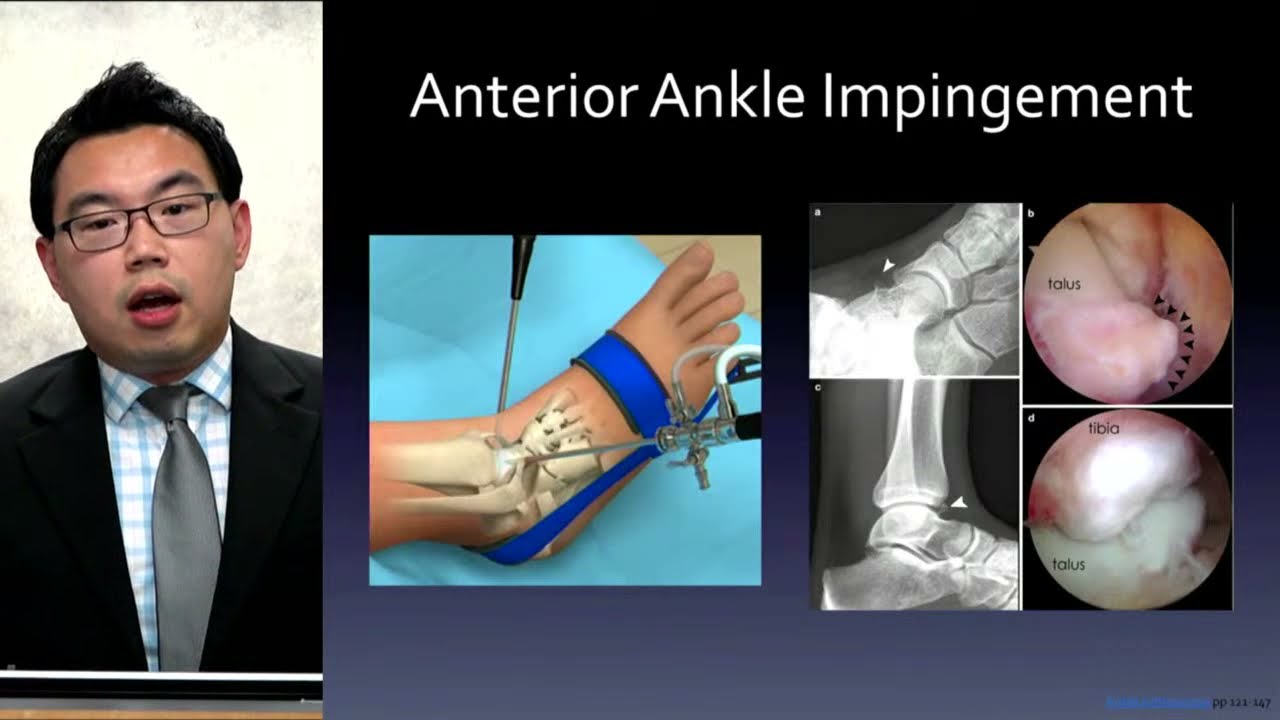 Why Does My Ankle Hurt? Causes and Treatment of Ankle Pain