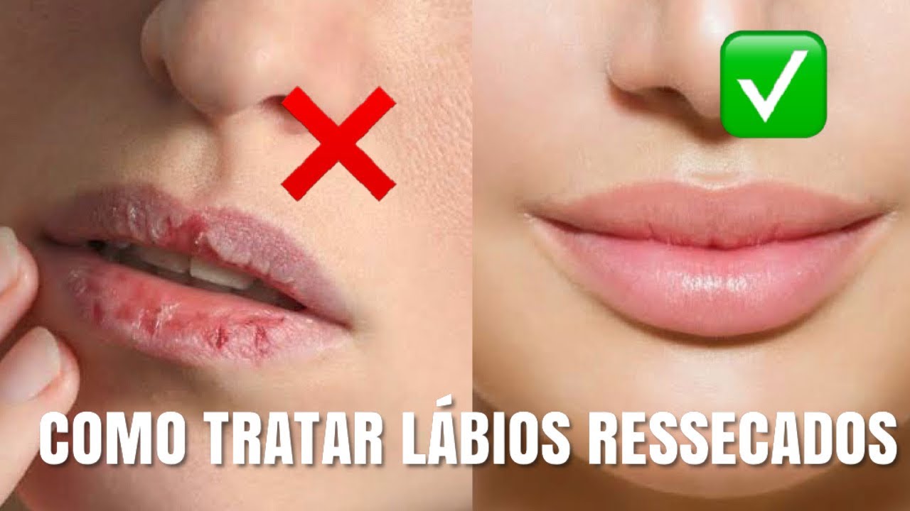 ADEUS BOCA RESSECADA! APRENDA COMO ACABAR COM LÁBIOS RACHADOS EM 2 MINUTOS