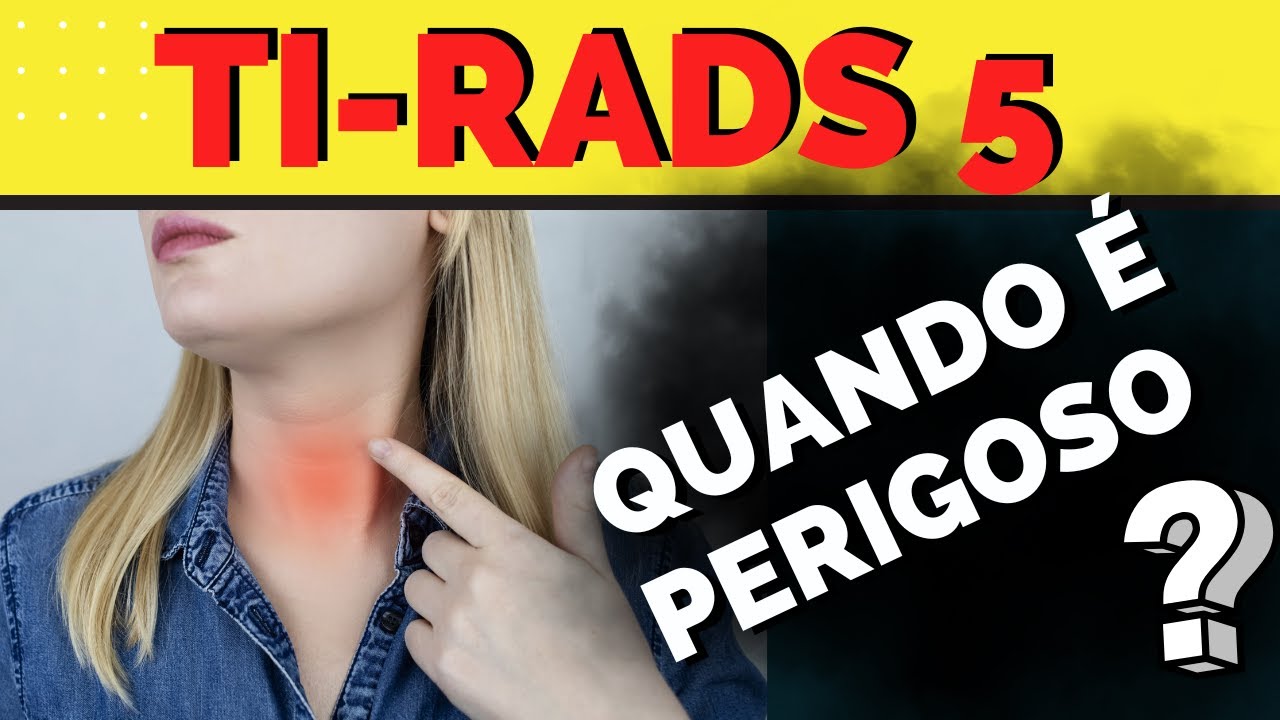Nódulo de Tireoide TIRADS 5 – Quando há risco e o que fazer?
