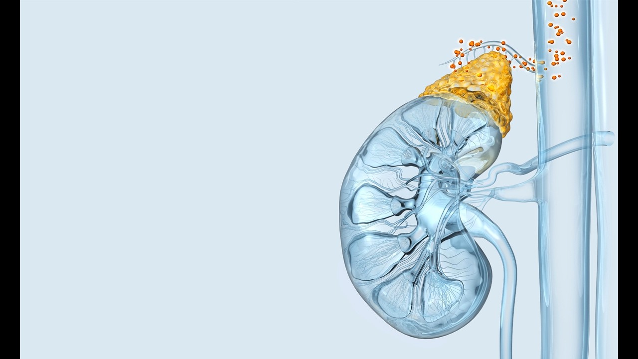 Hiperplasia suprarrenal congénita: Un diagnóstico sombrío para el recién nacido